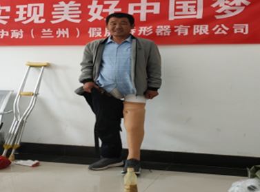 合金四連桿氣壓膝大腿假肢
