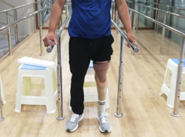 鎂合金雙叉動(dòng)踝腳小腿假肢 