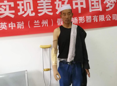 前臂一自由度被動(dòng)旋腕肌電手