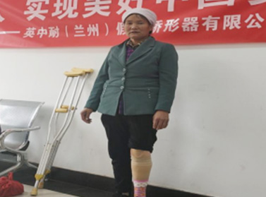 鎂合金雙叉動(dòng)踝小腿假肢